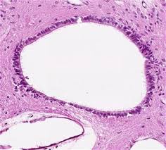 Spinal cord, in anatomy, that part of the central nervous system in man which lies in the spinal canal formed by the vertebrae, and reaches from the foramen magnum to the lower margin of the first lumbar vertebra. Spinal Cord Central Canal