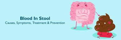 Image result for Blood in stool