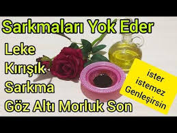 Ister Istemez Genclestiren Goz Alti Morluklari Leke Kirisik Sarkmalar Icin Kusursuz Cilt Maskesi Youtube 2020 Organik Cilt Bakimi Alerjiler Sac Ve Guzellik