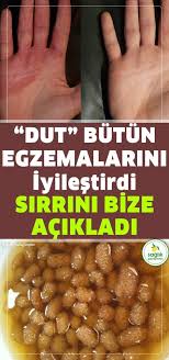 Dutu Boyle Kullandi Butun Egzemalarindan Kurtuldu Sirrini Bizle Paylasti Egzemaya Ne Iyi Gelir Iste Cevabi Egzema Iyi Saglik Dogal Tedaviler Dogal Saglik