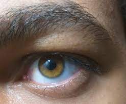 The following 5 files are in this category, out of 5 total. File Amber Eyes Jpg Wikipedia