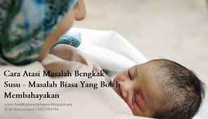 5 tips banyakkan susu badan. Bengkak Susu Ketahui 6 Cara Atasi Masalah Bengkak Susu Ibu Dalam Pantang Sihat Cantik Secara Semulajadi