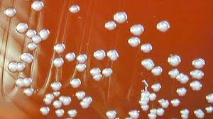 Image result for Pseudoeriosema