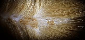 Image result for flea bite