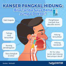 Zairul azwan mohd azman, pakar perunding pembedahan kolorektal dari ukm specialist centre berkongsi. Hello Doktor Kanser Hidung Adalah Kanser Ke 4 Kerap Di Facebook