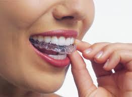 These braces are made of polyurethane plastic. Invisalign Teeth Straightening Bridge Street Dental