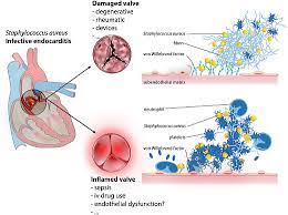 Valvular Medicine European Heart Journal Oxford Academic