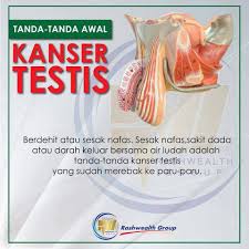 Ayuh bantu diri atau orang lain rawat penyakit ini! The Reporter Tanda Tanda Awal Kanser Facebook