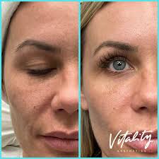 Vitality Aesthetics (@vitalityaesthetics.us) · Happy Valley, OR