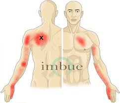 Muscle And Joint Pain Of The Upper Arm Imbue Pain Relief Patch Fibroness Pain Relief Patches Rib Pain Chest Muscles