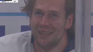 Brandon Carlo busted open in first fight as a Maple Leaf.