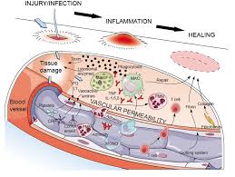 نتیجه جستجوی لغت [inflammatory] در گوگل