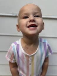 Prosthetic eye for childhood cancer patient