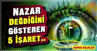 Nazara Kimi Insan Inanirken Kimiside Bunu Hurafe Olarak Gorur Aslinda Nazar Diye Birsey Var Yani En Azindan Goz Degmesi Naza Isaretler Bilgi Dogal Tedaviler