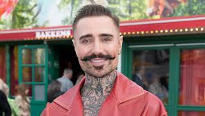 Tinus de Schunard har fået lavet tænder i Tyrkiet og deler sin  skrækoplevelse fra klinikken.