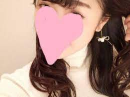 脂肪注入したらなくならないと思われている方が多いのですが なくなる方もいらっしゃいます ヒアルロン酸が確実になくなるのに比べたら 定着するかもしれないし なくなるかもしれないのが脂肪移植となりますので 確実になくならないという保障は 少し難しいのが