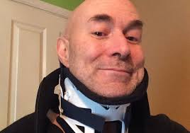 Going under the knife really slows you down…