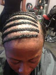 Cornrows Hairstyle For Receding Hairline Hairstyles For Receding Hairline Receding Hair Styles Hair Styles