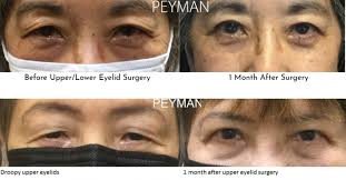 Jason Sabet-Peyman, MD