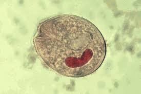 Image result for Balantoides Coli