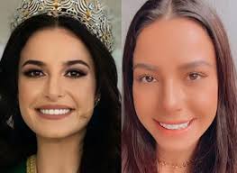 Gama was born in porto alegre in the state of rio grande do sul, brazil. Miss Brasil 2020 Faz Procedimento Para Dar Levantadinha No Nariz Celebridades O Dia