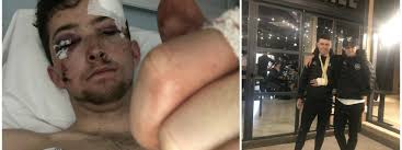 Un ciclista británico denuncia que una furgoneta en España le tiró a un  barranco