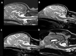Midsagittal Mr Brain Images Midsagittal Mr Brain Images T2 Weighted Download Scientific Diagram
