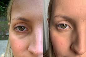 Biossance Squalane Peptide Eye Gel Before And After On The Hunt For An Eye Gel That Really Works One Writer Reviews Biossance Squalane Peptide Eye Gel To Get Rid O In 2020 Undereye Circles Undereye Lightening Eye Gel