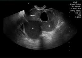 Check spelling or type a new query. Abdominal Pain In Nonpregnant Female Patients 2014 04 06 Ahc Media Continuing Medical Education Publishing