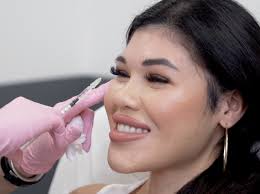 Botox in Santa Barbara, CA