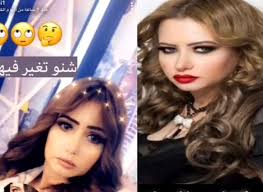 قبل إجراء اى عملية جراحية من عمليات التجميل في تركيا يتوجب على المريض التفكير جيداً فى المركز الذى سيقوم بإجراء العملية فيه، والطبيب الذى سيُجرى العملية ؛ لان العمليات الجراحية محفوفة بالمخاطر ولابد للمريض أن يكون على دراية تامة بالعمليات الجراحية. Ù…ÙŠ Ø§Ù„Ø¹ÙŠØ¯Ø§Ù† ØªÙØ§Ø¬Ø¦ Ø¬Ù…Ù‡ÙˆØ±Ù‡Ø§ Ø¨Ù„ÙˆÙƒ Ø¬Ø¯ÙŠØ¯ Ù‡Ù„ Ø®Ø¶Ø¹Øª Ù„Ø¹Ù…Ù„ÙŠØ§Øª ØªØ¬Ù…ÙŠÙ„ ØµÙˆØ±