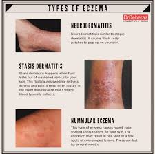 Image result for Neurodermatitis