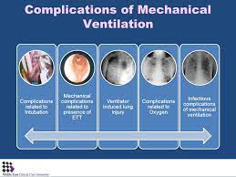 Pin On Mechanical Ventilation
