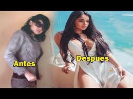 Es importante destacar que 'la segura' reveló, en uno de sus videos de julio de 2017, que también se había en el mismo material la joven negó haberse operado la nariz y haberse realizado una bichectomía (retirarse bolas de grasa. La Segura Antes Y Despues De Ser Famosa Y Sin C1rug1a Youtube