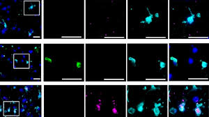 「壊れた脳は治らない」を覆す | Science Tokyo - 東京科学大学