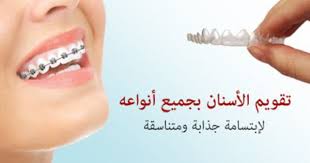 دكتور أسنان عيادات الأسنان في مدينة جدة السعودية عيادات ماريز لطب الأسنان Blog Posts Septum Post