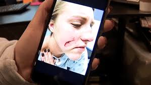 ATTACKED IN HIGHLANDTOWN