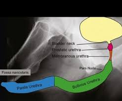 Image result for Retrograde Urethrogram