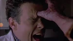 Why doesn't Michael have any burn marks