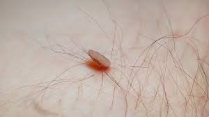 The dermis is the second layer, thicker, while the l. Cancerous Skin Tags Pictures And When To See A Doctor