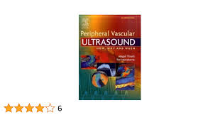 Peripheral Vascular Ultrasound: How, Why and When