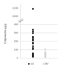 Fecal Calprotectin Levels In Healthy Controls And Patients