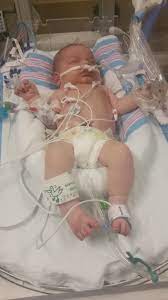 Today my son had a balloon in his heart to fix a bicuspid aortic stenosis. He also has an enlarged vessel or tube of some sort and heart is thickened for working
