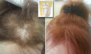 Biotin is essential for the production of a hair protein called keratin, which is why biotin supplements are often marketed for hair growth. Does Help Hair Whey Protein Shake Work Daily Mail Online