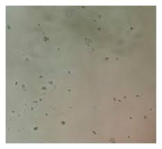 Image result for Triumfetta welwitschii