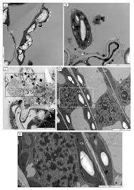 Maybe you would like to learn more about one of these? Cells Free Full Text Modifications In Tissue And Cell Ultrastructure As Elements Of Immunity Like Reaction In Chenopodium Quinoa Against Prune Dwarf Virus Pdv