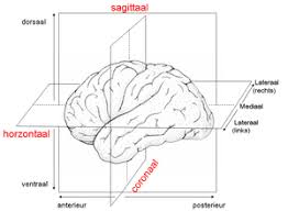 Sagittal and axial sections of the brain + Category Human Brain Sagittal Section Wikimedia Commons