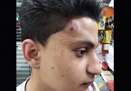 Paterson cop under investigation in beating of 19-year-old faces a second  accuser