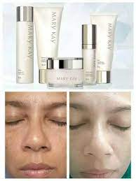 Punca dan cara atasi jerawat assalamualaikum…. Masalah Jeragat Pigmentasi Mary Kay Beauty Consultant Facebook