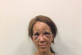 Fundraiser by Sharon Hersh : Kristin Hersh brain bleed